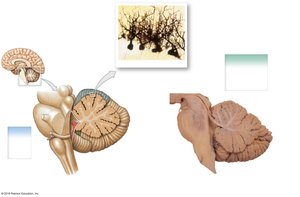 Sagittal view of the cerebellum showing gray and white matter and Purkinje cells