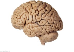 Lateral view of the brain showing lobes and sulci