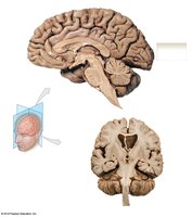 Sagittal and coronal sections of the brain showing internal structures