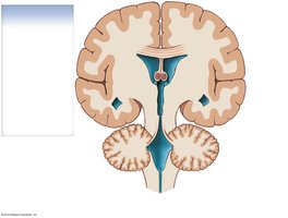 Coronal section of the brain showing the ventricular system