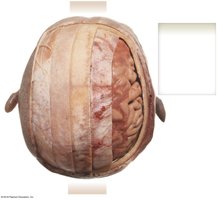 Cranial meninges covering the brain
