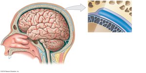 Lateral view of the brain showing the meninges and their relationship to the cranium
