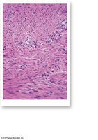 Smooth muscle tissue in longitudinal and transverse section