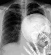 X-ray image showing anatomical structures