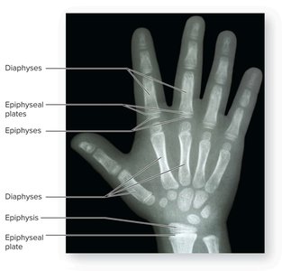Appositional growth of bone in cross-section from infant to adult