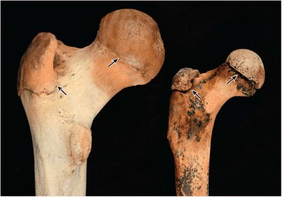 Blood supply to a long bone