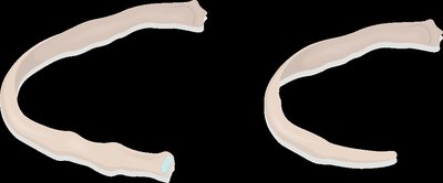 Comparison of true and floating ribs