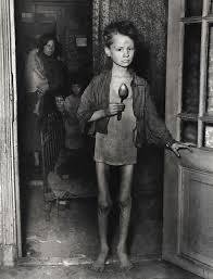 Dutch Hunger Winter: malnutrition and epigenetic effects