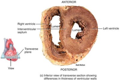 Transverse section showing thickness of ventricular walls