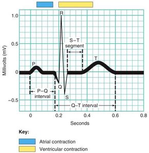 Electrocardiogram (EKG) tracing