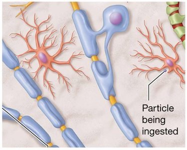 Microglia ingesting particles
