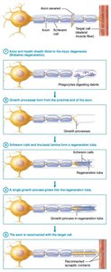 Steps of axon regeneration in PNS