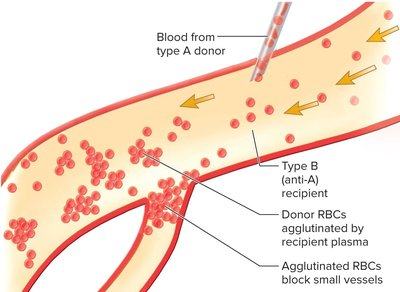 Effects of mismatched transfusion