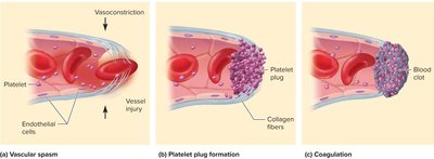 Hemostasis: vascular spasm, platelet plug, coagulation