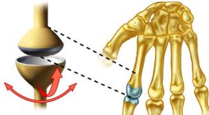 Condyloid joint