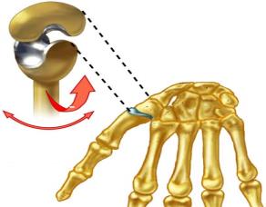 Saddle joint