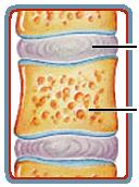 Symphysis joint (intervertebral disc)