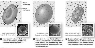 Effects of isotonic, hypotonic, and hypertonic solutions on red blood cells