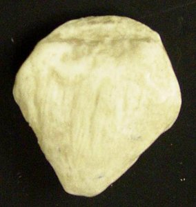 Patella (sesamoid bone)