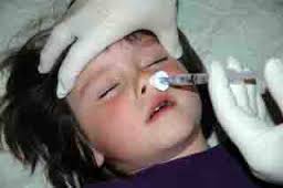 Intranasal administration