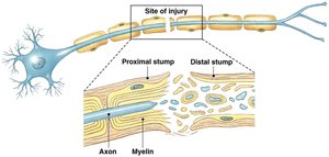 Axon injury and regeneration