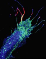 Growth cone of a developing axon