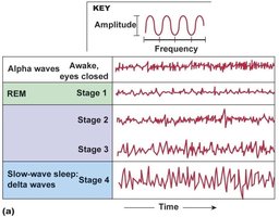 EEG patterns in sleep stages