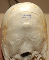 Lateral view of the mandible
