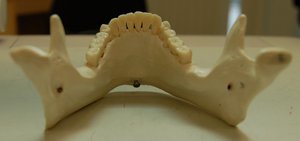 Atlas vertebra (C1) inferior view