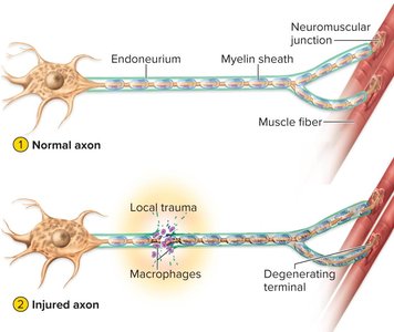 Normal and injured axon