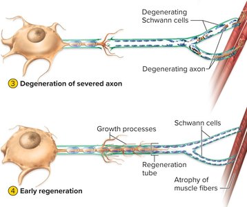 Degeneration and early regeneration