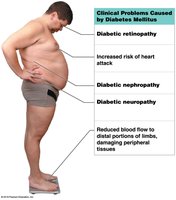 Clinical problems caused by diabetes mellitus