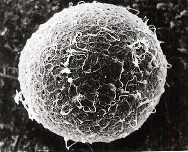 Microscopic image of the ovum