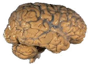 Photograph of a human brain