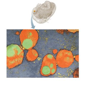 Lysosome structure