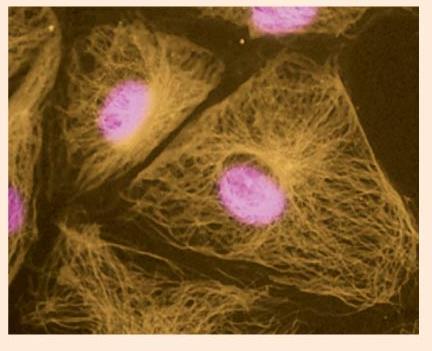 Cytoskeleton in cells