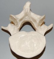 Sacrum with sacral foramina and hiatus