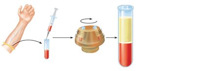 Blood sample collection and centrifugation