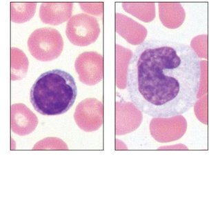 Agranulocyte types: lymphocyte and monocyte