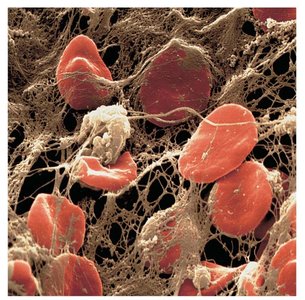 Coagulation and fibrin mesh formation