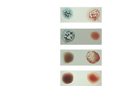 Blood typing reactions