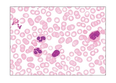 Microscopic view of blood cells
