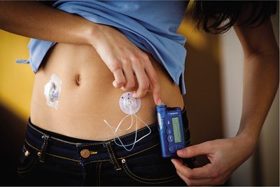Insulin infusion pump for diabetes management