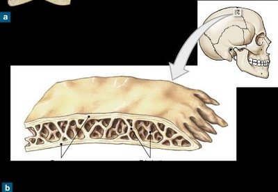 Flat bone structure and spongy bone