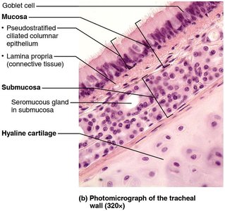 Photomicrograph of the tracheal wall