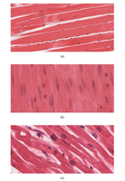 Histological comparison of skeletal, cardiac, and smooth muscle tissue