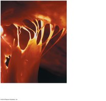 Papillary muscles and chordae tendineae supporting AV valves