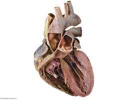Anterior view of a sectioned heart showing internal features and valves