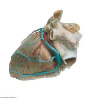 Posterior view of the heart with colored latex-injected vessels