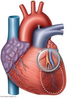Occluded coronary artery and damaged heart muscle